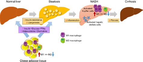 Figure 1 from Nonalcoholic Fatty Liver Disease and Insulin Resistance ...