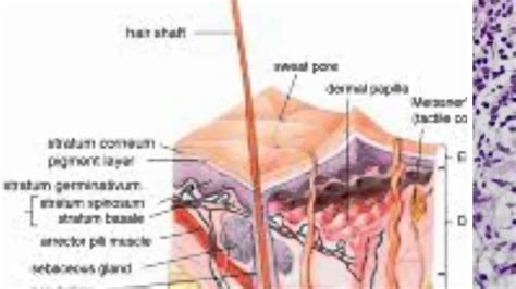 Hidradenitis Suppurativa Surgery - YouTube