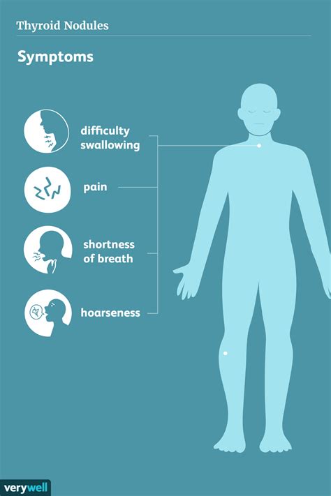 Thyroid Nodules: Symptoms, Causes, Diagnosis, Treatment, and Coping