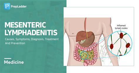 Mesenteric Lymphadenitis: Causes, Symptoms, Diagnosis, Treatment and ...