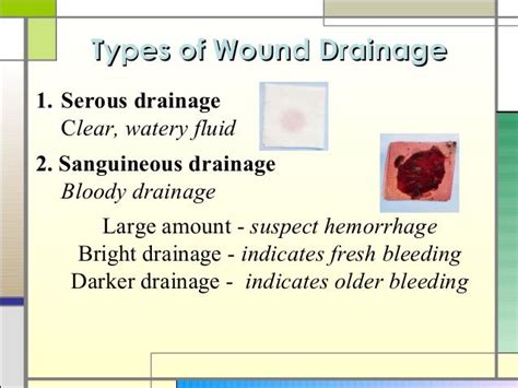 types of draiange from wounds | Wound healing nursing, Wound care nursing, Nursing school notes