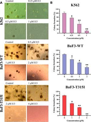 Frontiers | I13 overrides resistance mediated by the T315I mutation in chronic myeloid leukemia ...