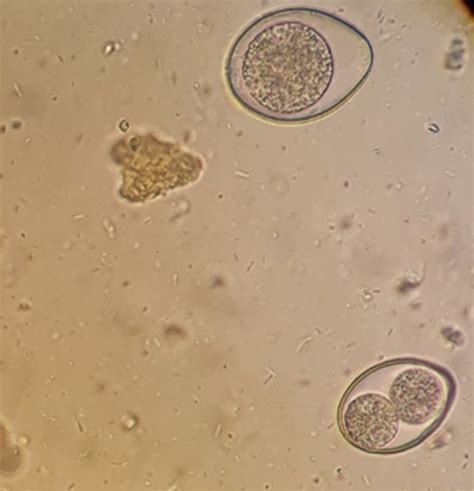 Intestinal Coccidia - Troccap