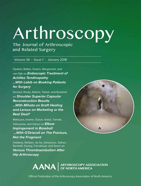 Arthroscopy Journal
