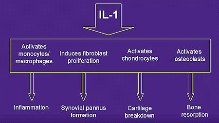 Interleukin-1 Inhibition at Treatment for Rheumatoid Arthritis on Johns Hopkins Arthritis