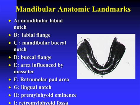 Retromolar Pad Anatomy