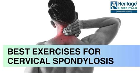 Top 7 Best Exercises For Cervical Spondylosis To Reduce Pain