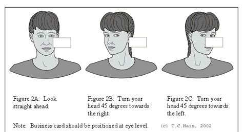 The Vestibular System’s Effect on Falls in Parkinson’s Disease ...