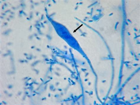 Fun With Microbiology (What's Buggin' You?): Microsporum audouinii