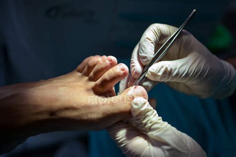 Podiatrist making procedure with patient — test, disease - Stock Photo ...