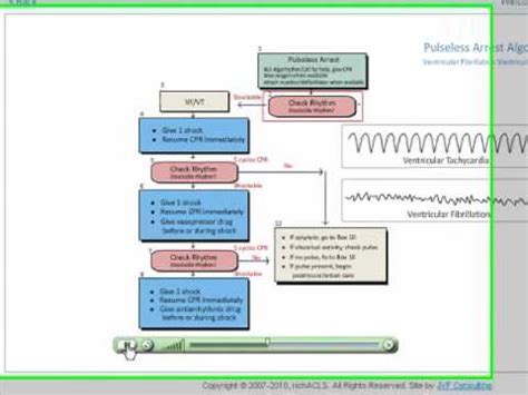 Pulseless Arrest, Ventricular Fibrillation/Ventricular Tachycardia Review - YouTube