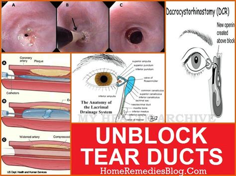 How to Clear Blocked Tear Duct in Babies and Adults Naturally - Home ...