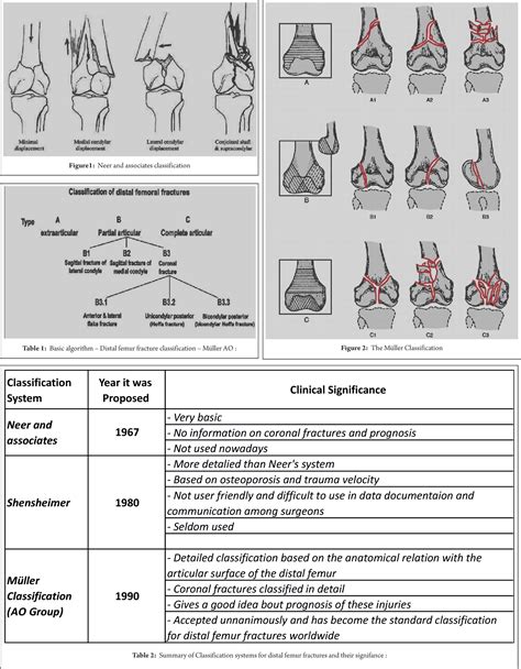 Distal Femur Fracture Classification