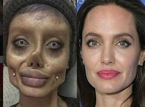 Teen's botched Angelina Jolie plastic surgery roils internet, proves to be an ingenious hoax ...