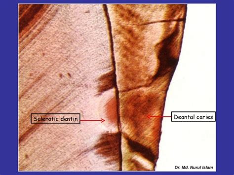 Dentin pulp complex