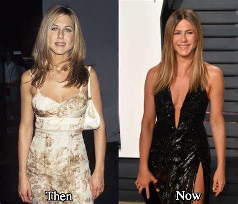 Jennifer Aniston Plastic Surgery Before and After Photos