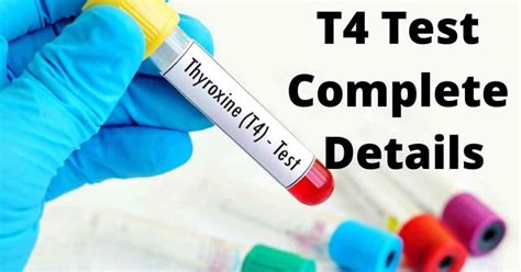 Thyroxine T4 Blood Test – DoctorOnHealth