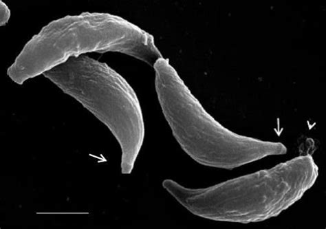 Small things considered — Toxoplasma gondii and psychopathology