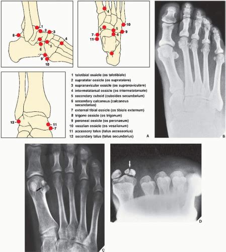 Lower Limb III: Ankle and Foot | Radiology Key