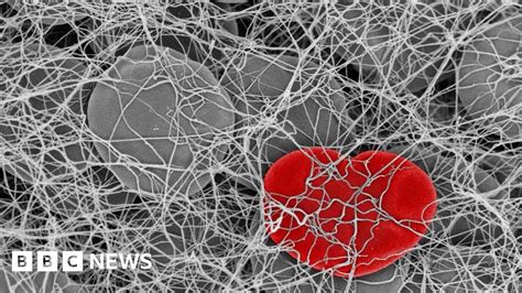 Heart-shaped red cell in blood clot photo wins competition - BBC News