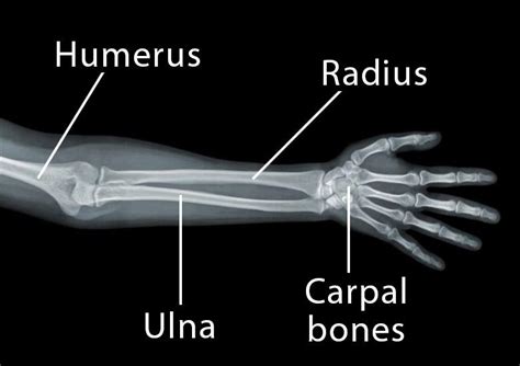 Radius: Definition, Location, Functions, Anatomy, Diagram