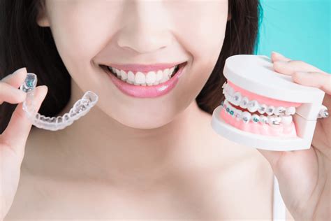 Dental Braces | Types of braces, Cost, And Procedure | How They work?