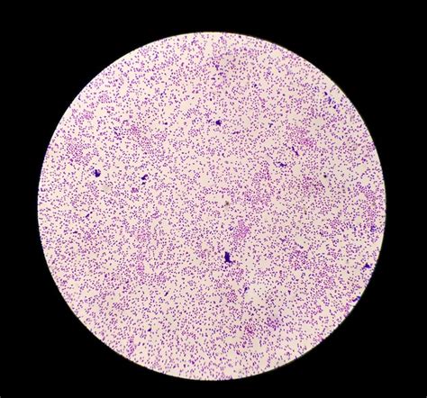 Premium Photo | Staphylococcus aureus bacteria colonie gram stain ...