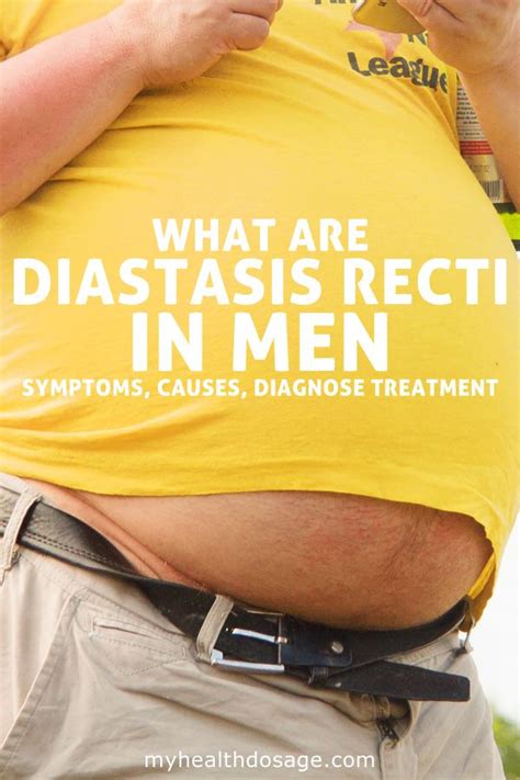 How to Identify and Fix Diastasis Recti In Men? | Diastasis recti repair, What is diastasis ...