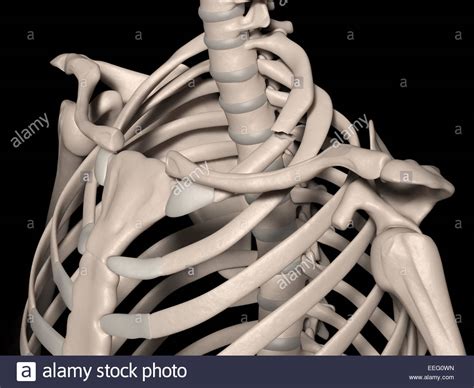 Digital medical illustration depicting a fracture of 1st rib (true Stock Photo: 77798609 - Alamy