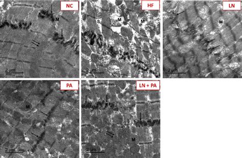 TEM images of intercalated discs in-between cardiac myofibrils in... | Download Scientific Diagram