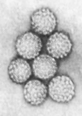 TEM of Polyomavirus - Stock Image - C013/0037 - Science Photo Library