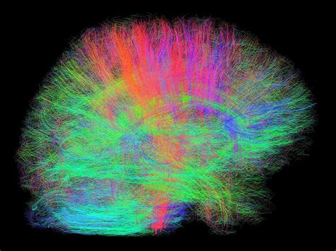 White Matter Fibres Of The Human Brain Photograph by Alfred Pasieka/science Photo Library - Pixels