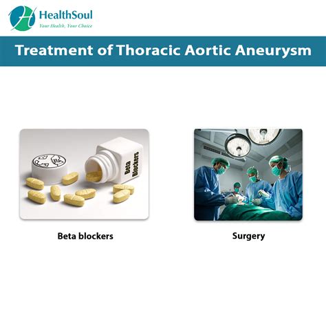 Thoracic Aortic Aneurysm – Healthsoul