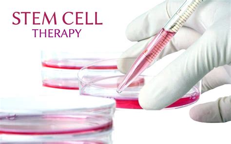 Stem Cell Therapy Shows Potential in Treating Medication-resistant Epilepsy Patients - EpilepsyU