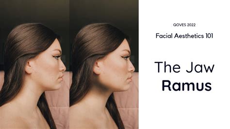 Concave Facial Profile : Why Your Jawline Never Looks Sharp | Facial ...