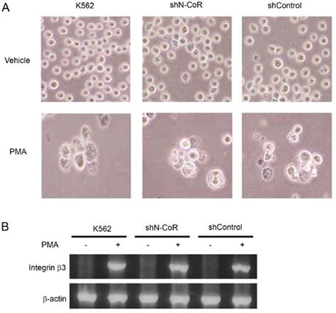 N-CoR is not required for the PMA-induced differentiation of K562 cells ...