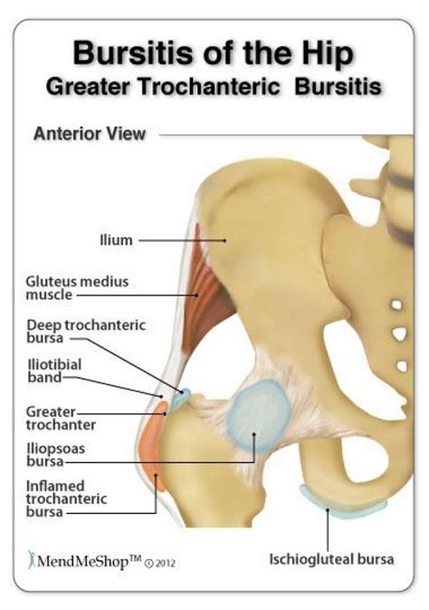 Pin on Lower Back Pain