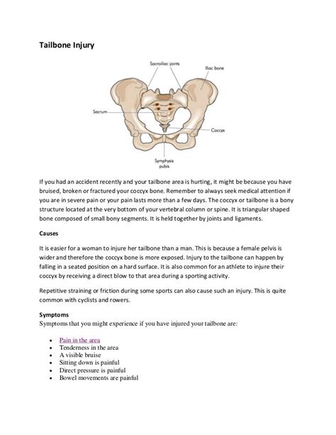 Tailbone injury