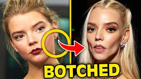 Top 10 Celebrities Who've Gotten BOTCHED From Buccal Fat Removal - YouTube