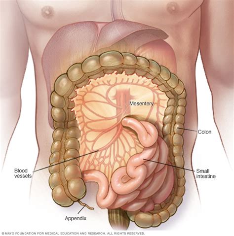 Sclerosing mesenteritis | Beacon Health System