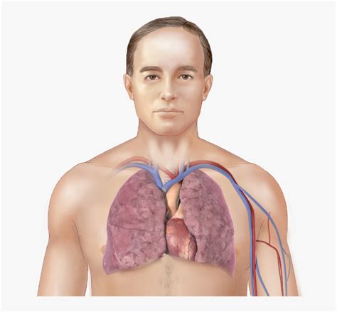 Lung Disease Pulmonary Fibrosis, HD Png Download - kindpng