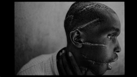 The Face Of A Rwanda Genocide Survivor - McKoysNews