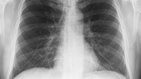 Pulmonary Medicine | JAMA Network