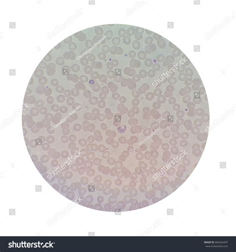 81 Malaria Microscope Stages Images, Stock Photos & Vectors | Shutterstock