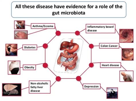 Friends who live in our Gut: Gut Microbiota | Science And Samosa