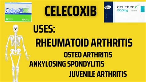 Celecoxib Uses, Side effects | Celebrex | celbex - YouTube