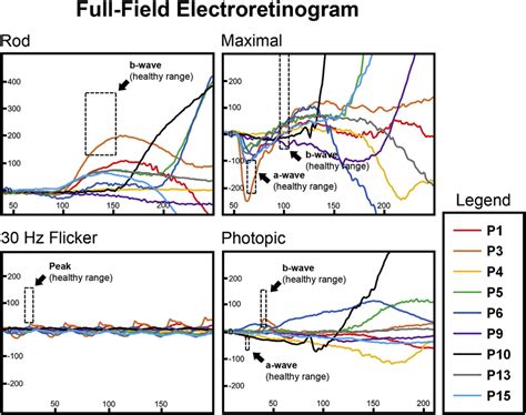 Full-field electroretinogram results in patients exhibiting the ...