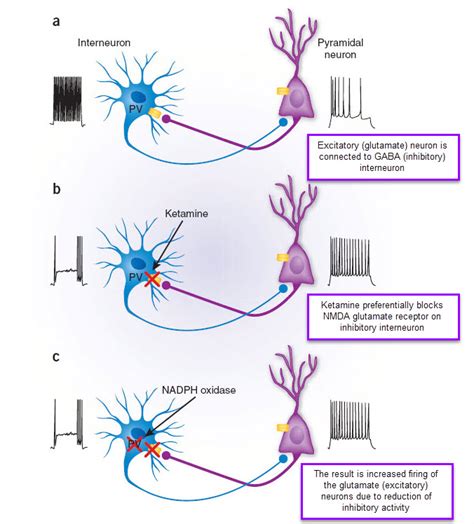 Ketamine for Depression - Mechanism of Action - Gateway Psychiatric