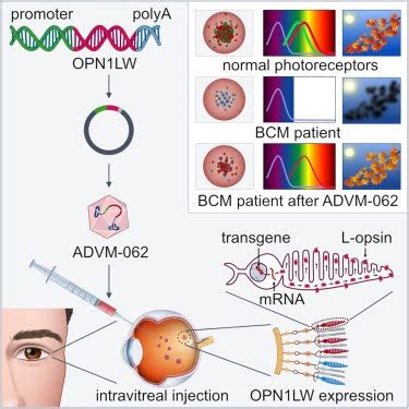 A Colorful Cure: How Gene Therapy Is Treating Blue Cone Monochromacy ...