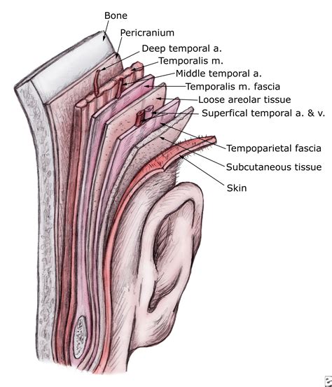 Oral Maxillofacial surgery: ความสับสนของ plane ระหว่าง temporopariental ...